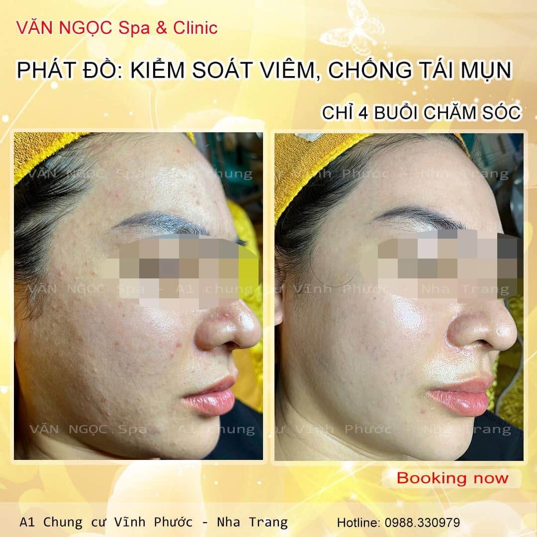 Quy trình phác đồ này rất đơn giản - ảnh 1