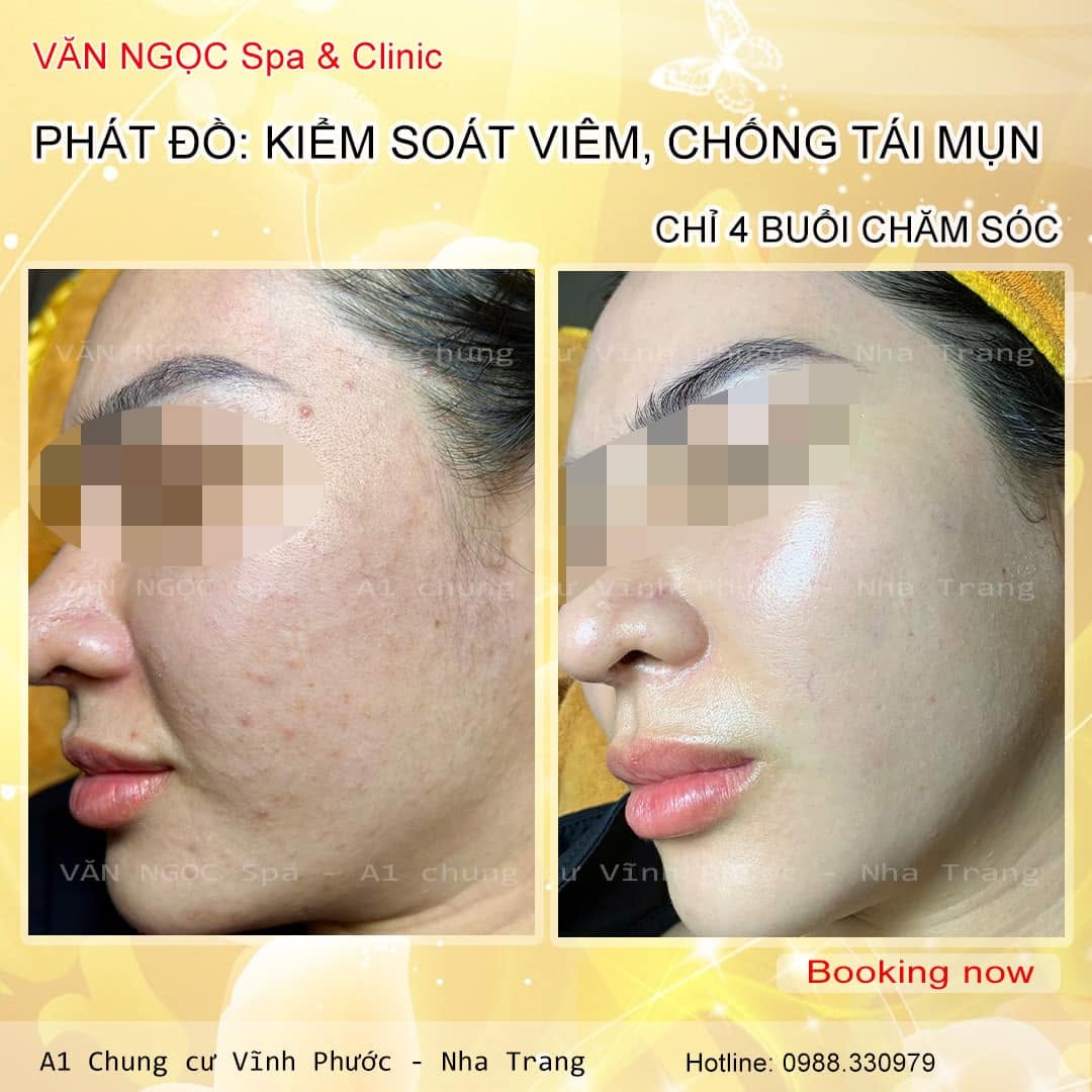 Quy trình phác đồ này rất đơn giản - ảnh 2