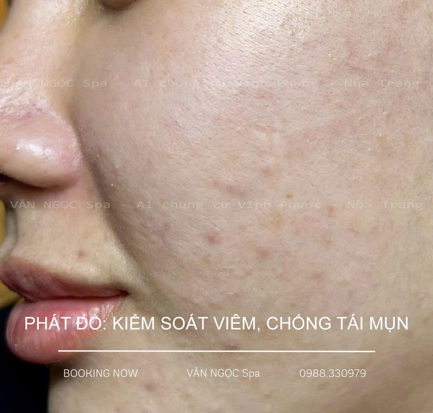Quy trình phác đồ này rất đơn giản - ảnh 3