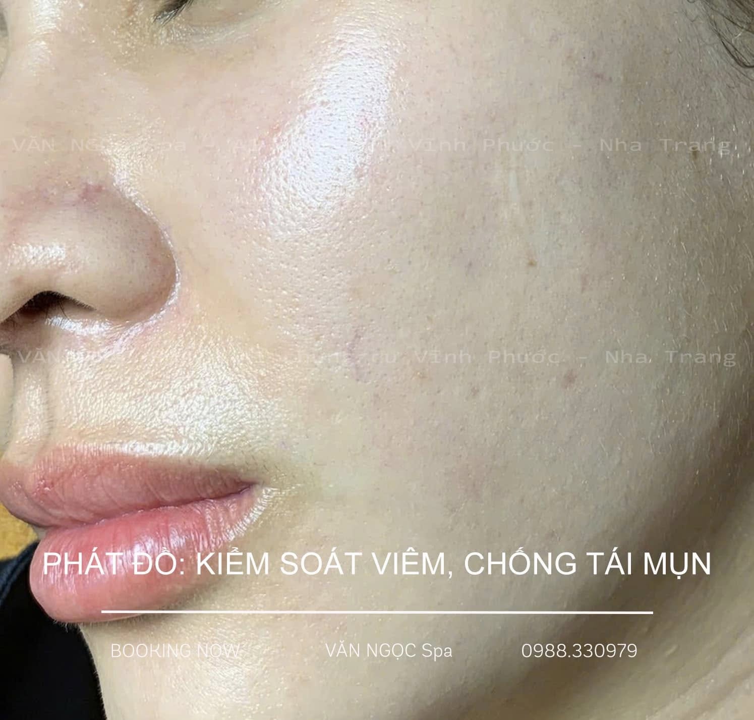 Quy trình phác đồ này rất đơn giản - ảnh 4