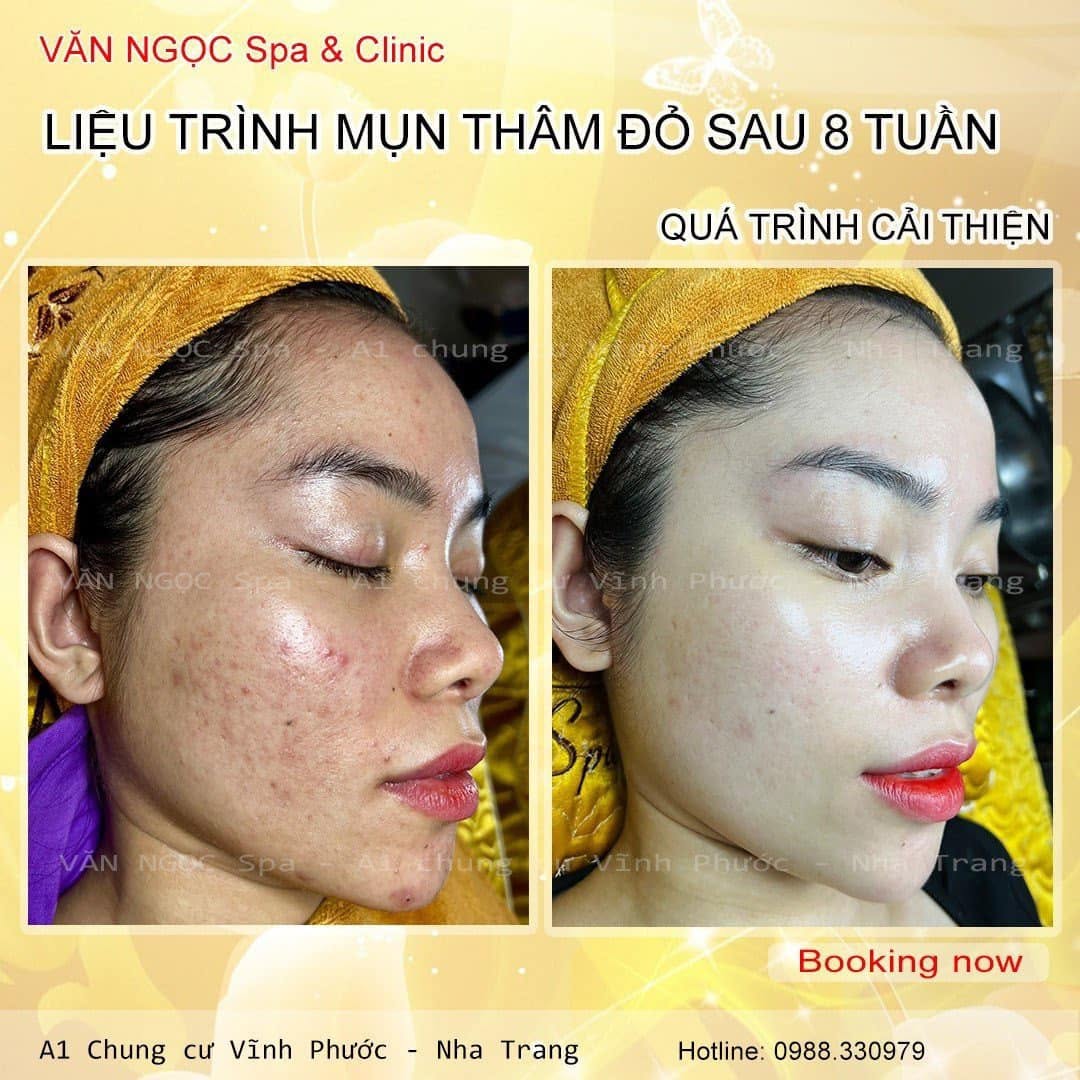 Hình ảnh theo dõi thực tế trong quá trình chăm sóc.