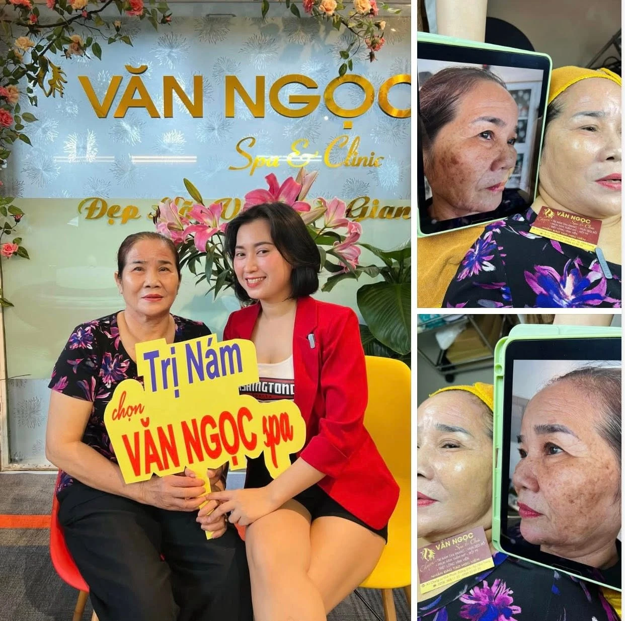 Hình ảnh nền da cần chăm sóc mụn và phục hồi tại Văn Ngọc Spa