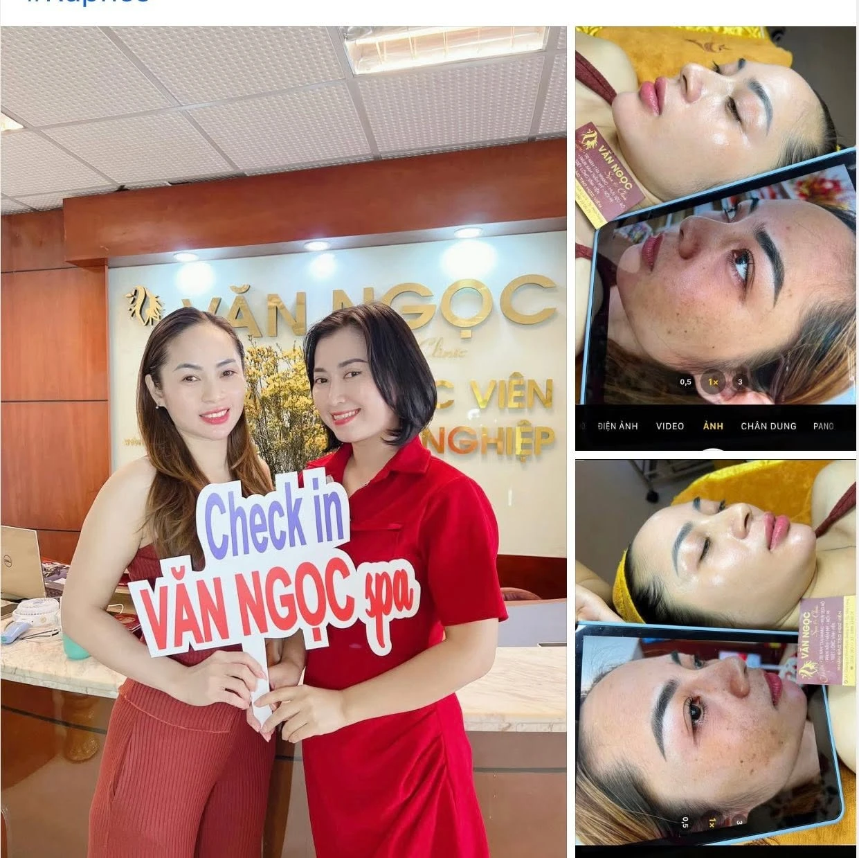 Hình ảnh làn da trong liệu trình chăm sóc sắc tố tại Văn Ngọc Spa